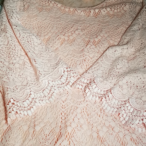 Lace H&M Dress - Picture 4 of 6